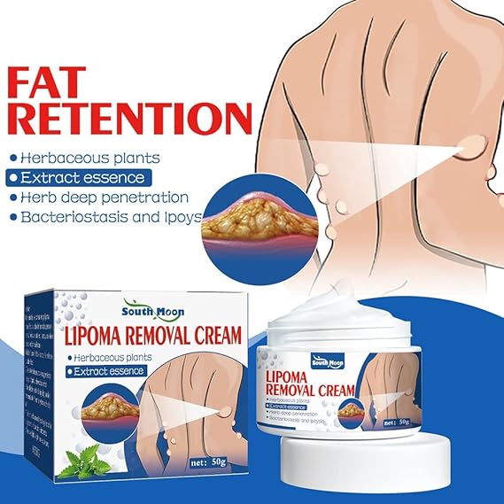 Lipoma Removal Cream | Buy 1 Get 1 Free