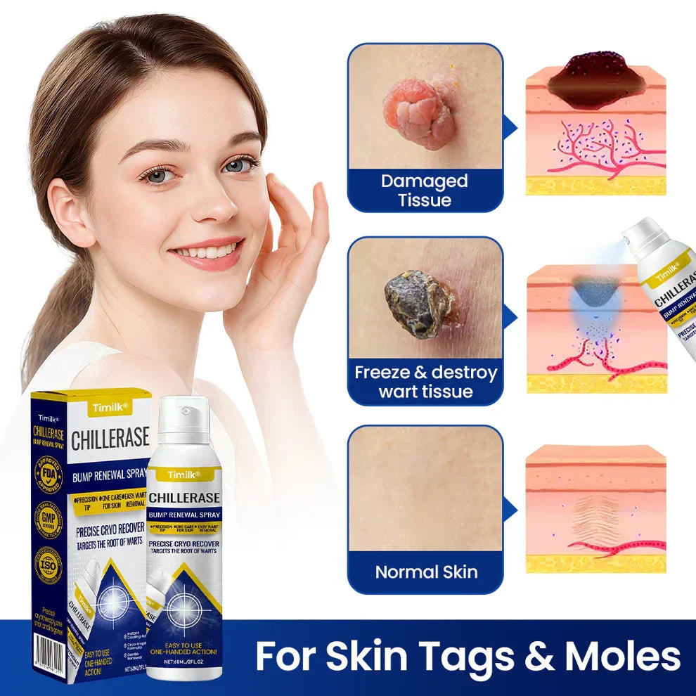 Timilk® ChillErase Bump Renewal Spray