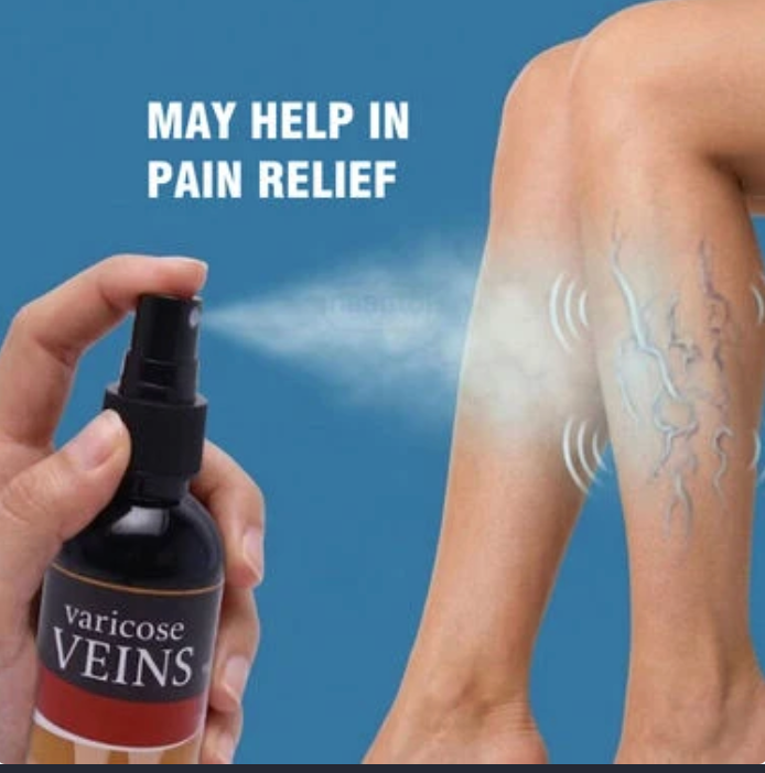 Varicose Veins Care Calming Spray (BPR9)