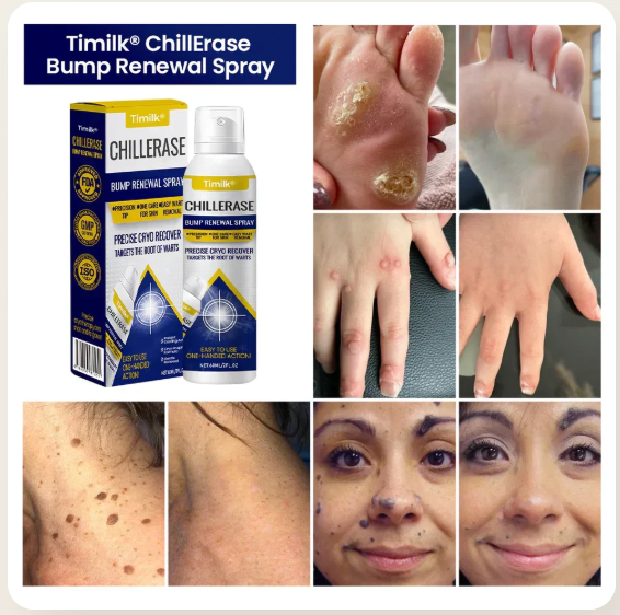 Timilk® ChillErase Bump Renewal Spray