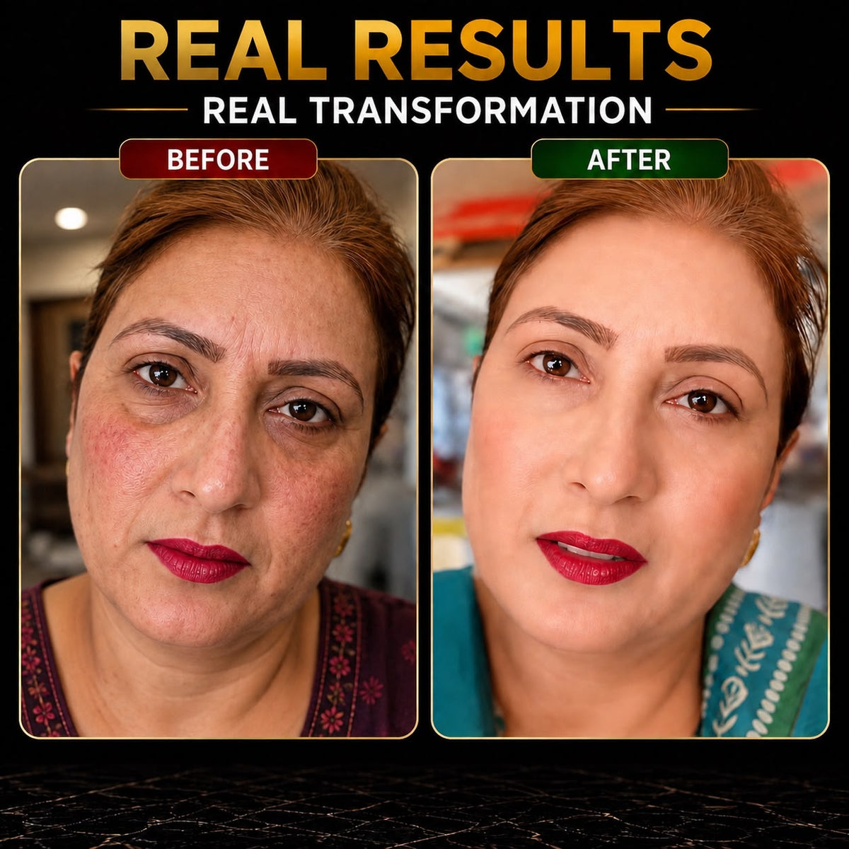 Buy Wiki Beauty Cream & Get Wiki Serum Free